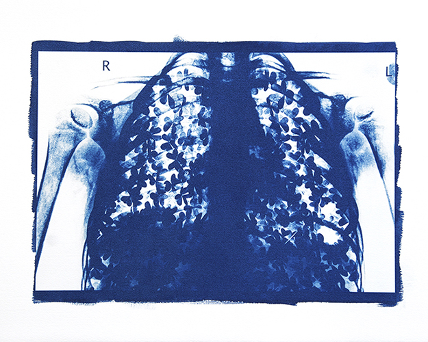 Condizioni interiori (Trifogli)