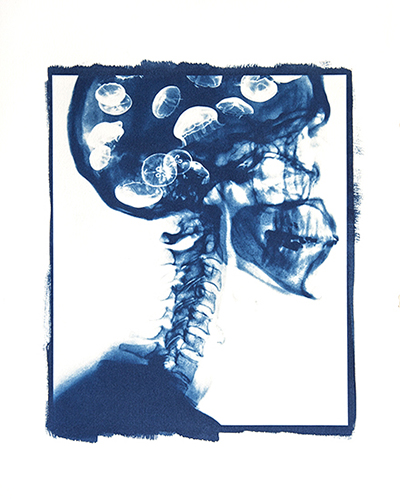 Condizioni interiori (Medusa)