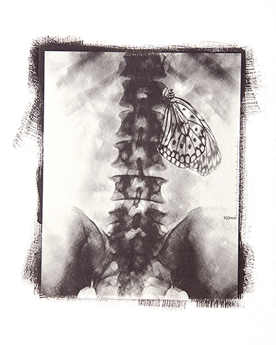 Condizioni interiori (Spleen)