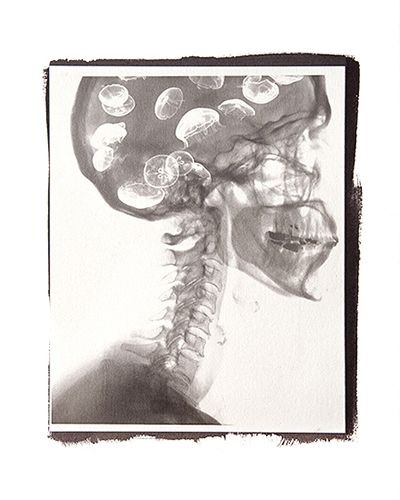 Condizioni interiori (Medusa)