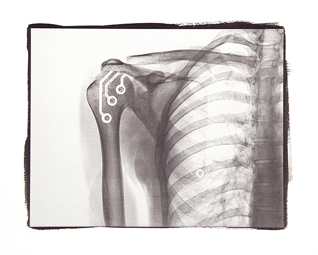 Condizioni interiori (Tatoo)