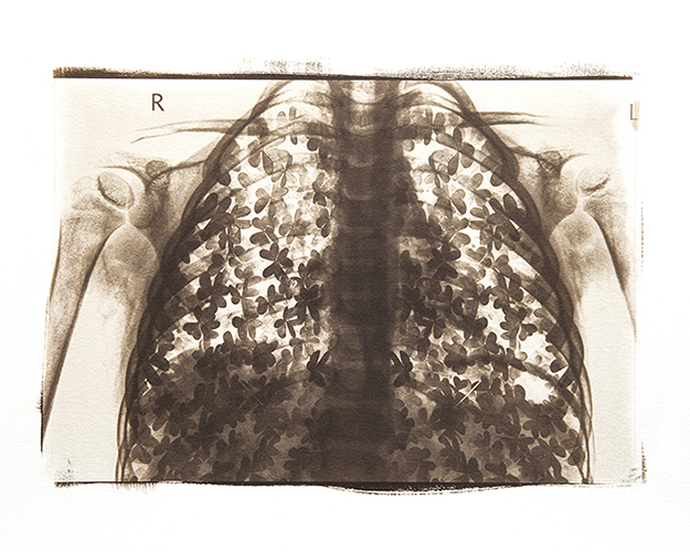 Condizioni interiori (Trifogli)