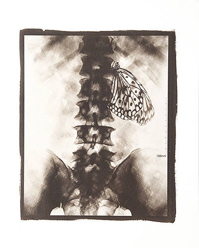 Condizioni interiori (Spleen)