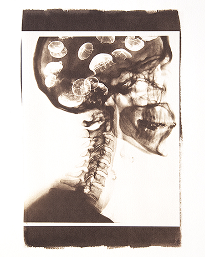 Condizioni interiori (Medusa)