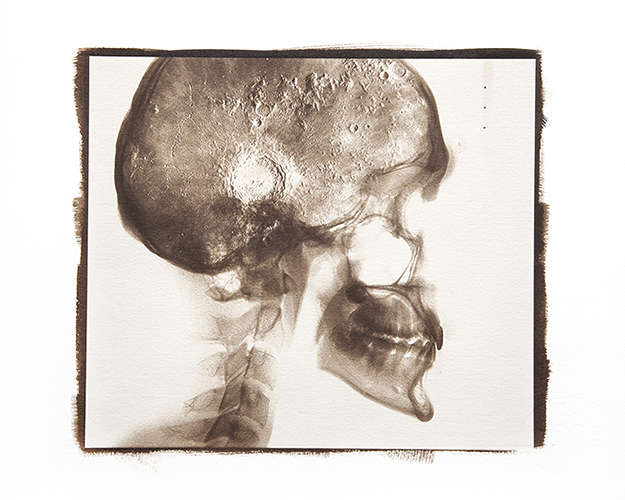 Condizioni interiori (Lunatico)