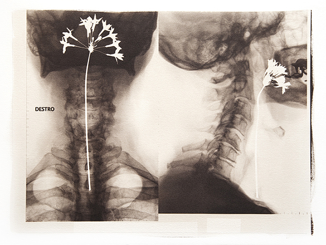 Condizioni interiori (L'uomo dal fiore in bocca)