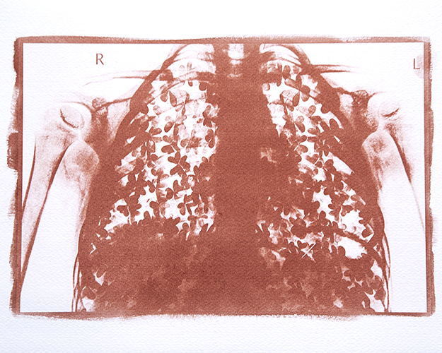 Condizioni interiori (Trifogli)