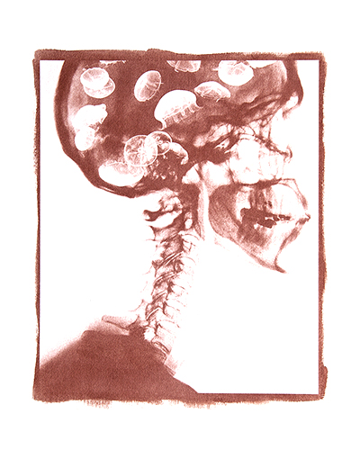 Condizioni interiori (Medusa)