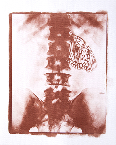 Condizioni interiori (Spleen)