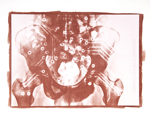 Condizioni interiori (AndroID)