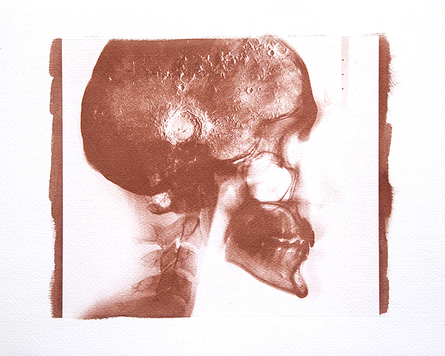 Condizioni interiori (Lunatico)